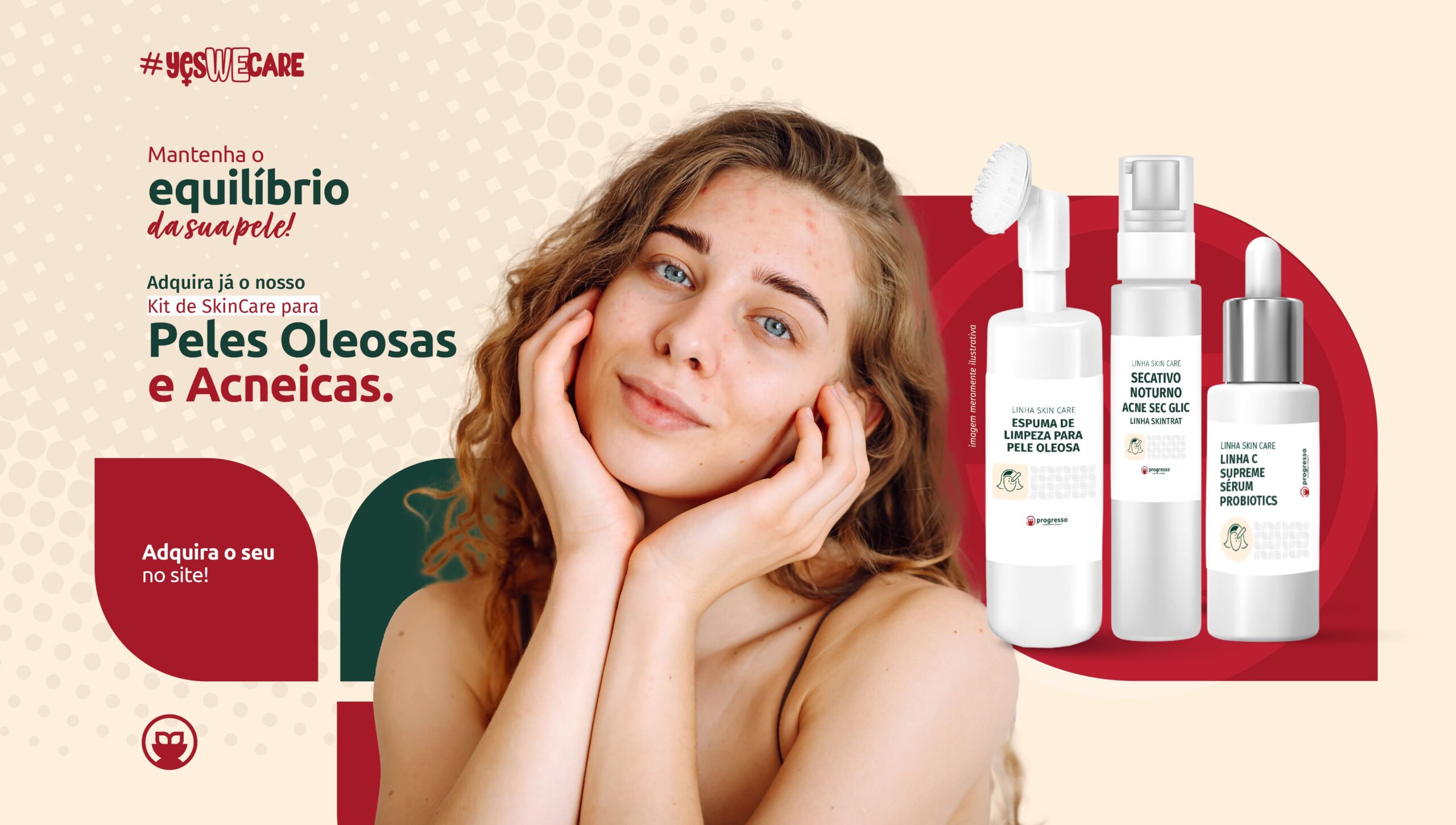 peles oleosas e acneicas