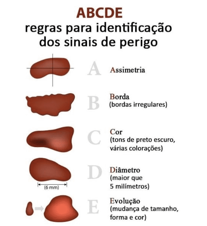 Guia completo: entendendo o câncer de pele para curtir o verão com segurança
