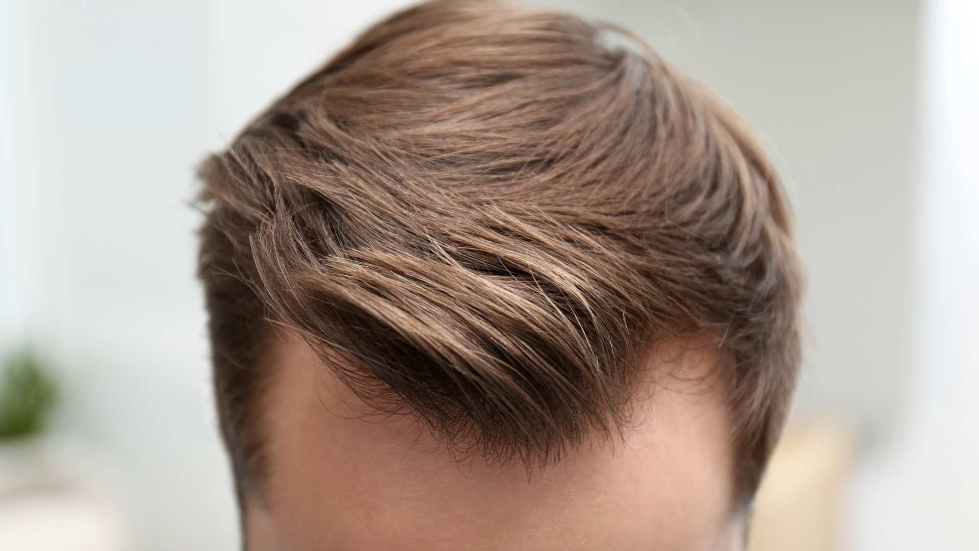 Minoxidil-crescimento-cabelos-barba-sobrancelhas (1)